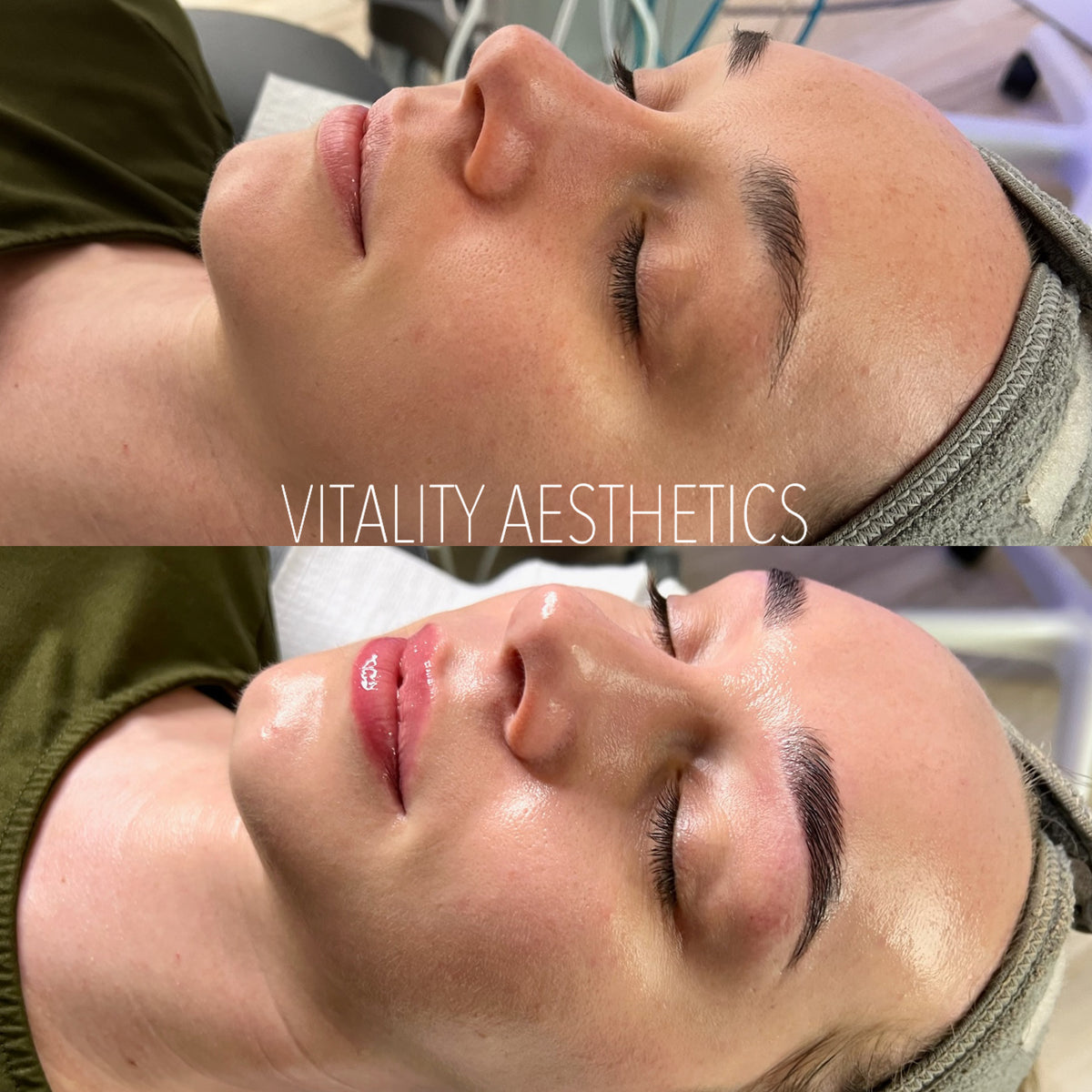 5 Reasons You Should Be Using Red Light Therapy